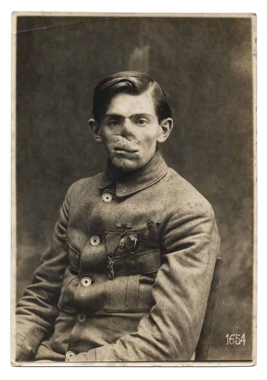 American Red Cross, WWI soldier facial reconstruction documentation photograph, about 1920