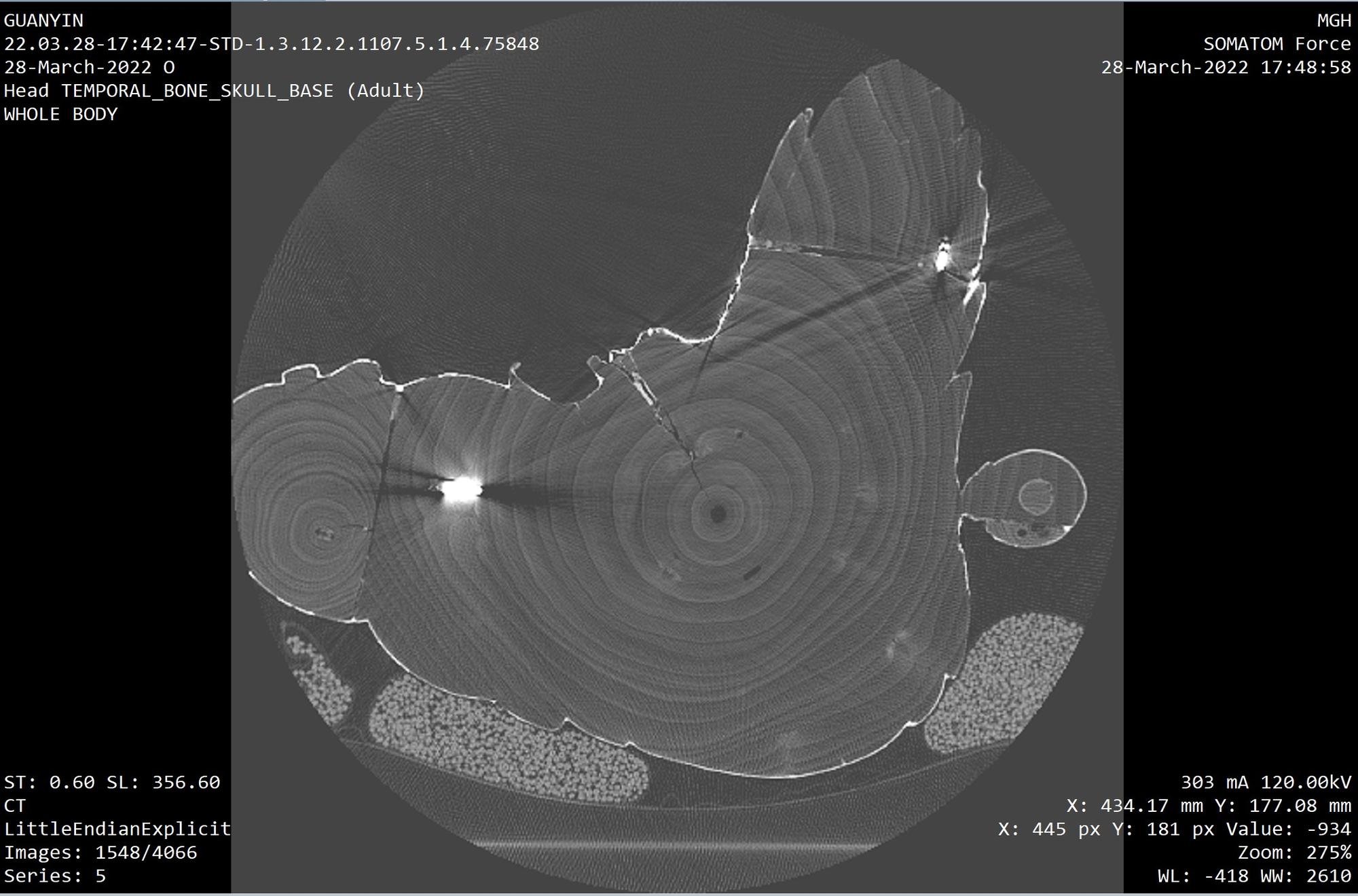 Black and white CT image of underside of sculpture revealing distinct wood growth rings and two bright white spots that are metal nails.